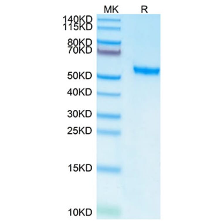 Tris-Bis PAGE - Recombinant Human ROR2 Protein (C-terminal His and Avi Tag) (A331227) - Antibodies.com