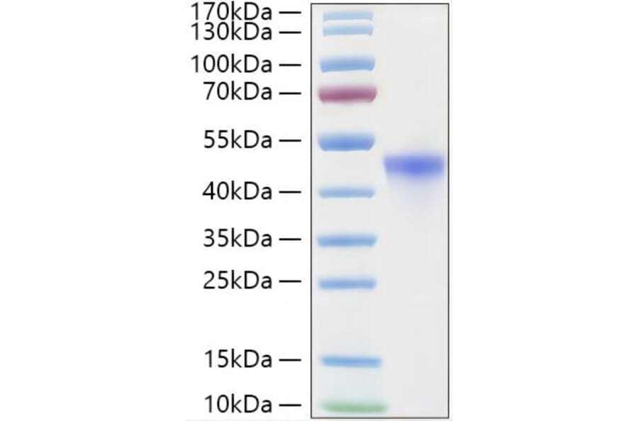 SDS-PAGE - Recombinant Human RRM2 Protein (C-terminal His Tag) (A331228) - Antibodies.com