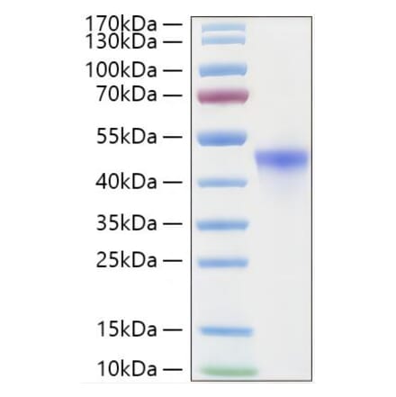 SDS-PAGE - Recombinant Human RRM2 Protein (C-terminal His Tag) (A331228) - Antibodies.com