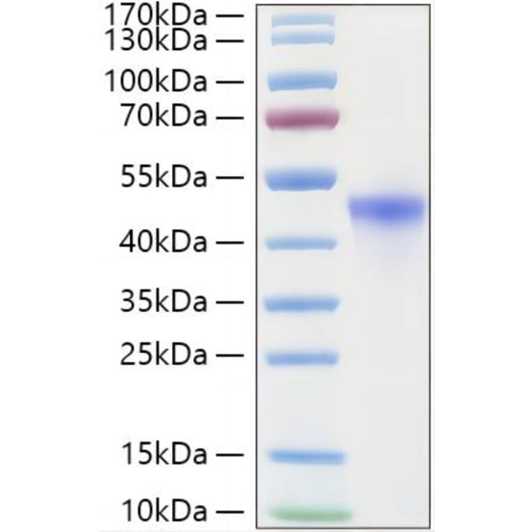 SDS-PAGE - Recombinant Human RRM2 Protein (C-terminal His Tag) (A331228) - Antibodies.com