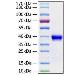 SDS-PAGE - Recombinant Human RSPO1 Protein (C-terminal His Tag) (A331229) - Antibodies.com