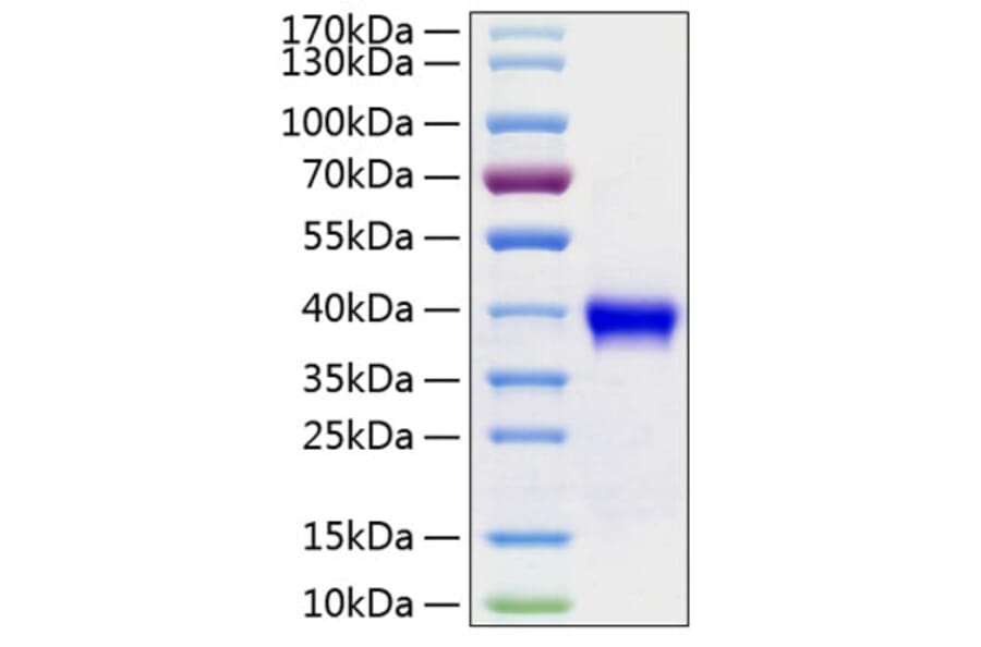 SDS-PAGE - Recombinant Human RSPO1 Protein (C-terminal His Tag) (A331229) - Antibodies.com