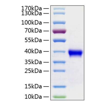 SDS-PAGE - Recombinant Human RSPO1 Protein (C-terminal His Tag) (A331229) - Antibodies.com