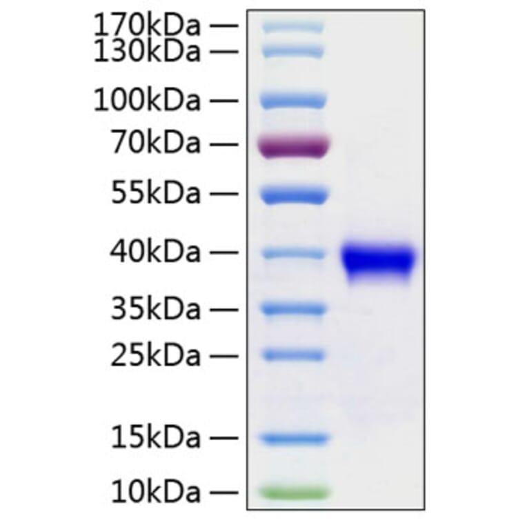 SDS-PAGE - Recombinant Human RSPO1 Protein (C-terminal His Tag) (A331229) - Antibodies.com
