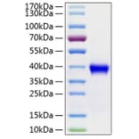 SDS-PAGE - Recombinant Human RSPO1 Protein (C-terminal His Tag) (A331229) - Antibodies.com