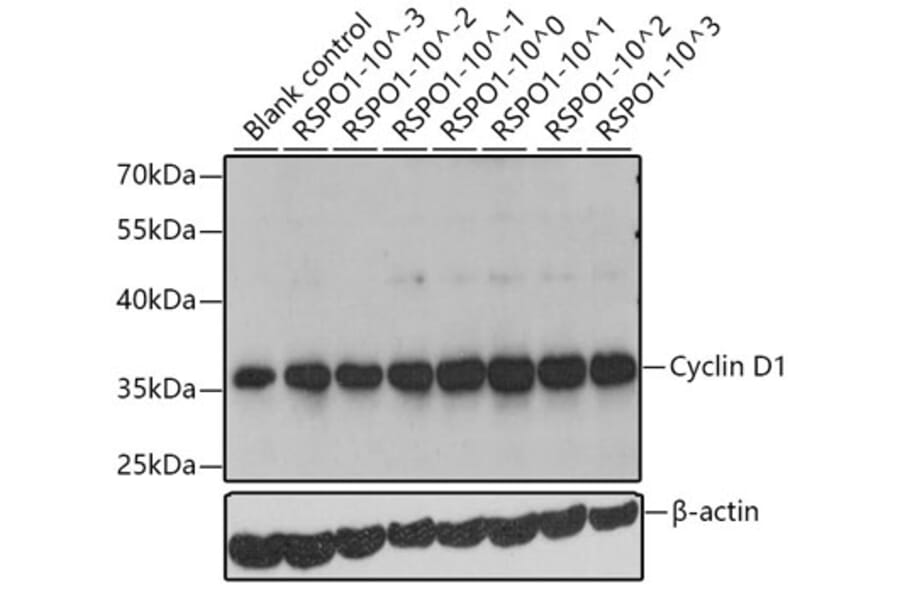 Western Blot - Recombinant Human RSPO1 Protein (C-terminal His Tag) (A331229) - Antibodies.com