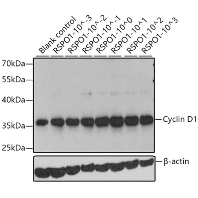 Western Blot - Recombinant Human RSPO1 Protein (C-terminal His Tag) (A331229) - Antibodies.com