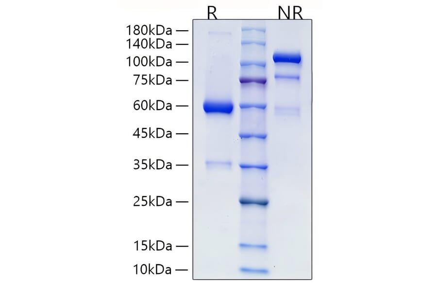 SDS-PAGE - Recombinant Human RSPO2 Protein (C-terminal Human Fc Tag) (A331230) - Antibodies.com
