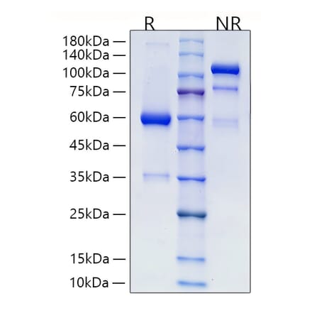 SDS-PAGE - Recombinant Human RSPO2 Protein (C-terminal Human Fc Tag) (A331230) - Antibodies.com