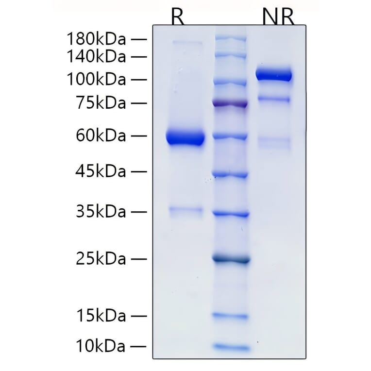 SDS-PAGE - Recombinant Human RSPO2 Protein (C-terminal Human Fc Tag) (A331230) - Antibodies.com