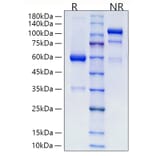 SDS-PAGE - Recombinant Human RSPO2 Protein (C-terminal Human Fc Tag) (A331230) - Antibodies.com
