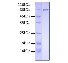 SDS-PAGE - Recombinant Human RSPO3 Protein (C-terminal Fc and His Tag) (A331231) - Antibodies.com