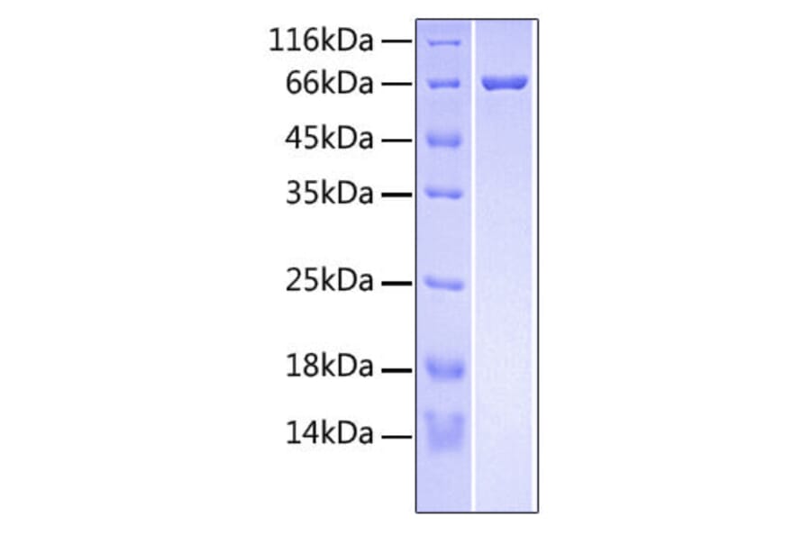 SDS-PAGE - Recombinant Human RSPO3 Protein (C-terminal Fc and His Tag) (A331231) - Antibodies.com