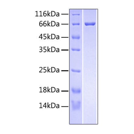 SDS-PAGE - Recombinant Human RSPO3 Protein (C-terminal Fc and His Tag) (A331231) - Antibodies.com