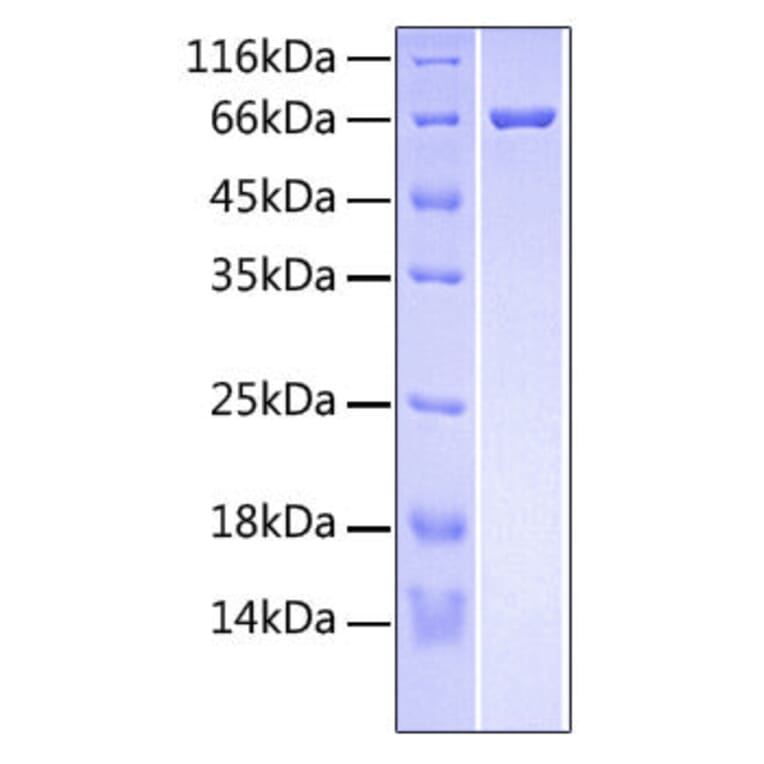 SDS-PAGE - Recombinant Human RSPO3 Protein (C-terminal Fc and His Tag) (A331231) - Antibodies.com