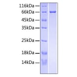 SDS-PAGE - Recombinant Human RSPO3 Protein (C-terminal Fc and His Tag) (A331231) - Antibodies.com