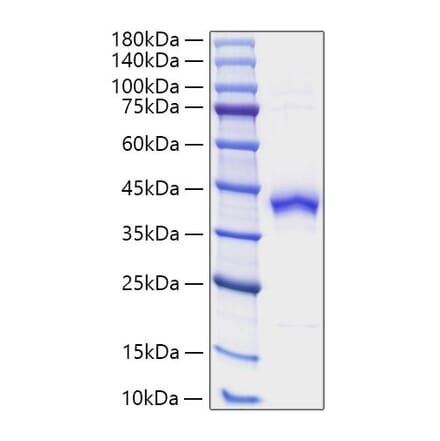 SDS-PAGE - Recombinant Human S100 beta Protein (N-terminal Human Fc and Avi Tag) (A331232) - Antibodies.com