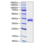 SDS-PAGE - Recombinant Human S100 beta Protein (N-terminal Human Fc and Avi Tag) (A331232) - Antibodies.com