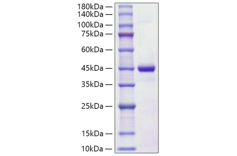 SDS-PAGE - Recombinant Human S100A7 Protein (C-terminal Human Fc Tag) (A331236) - Antibodies.com