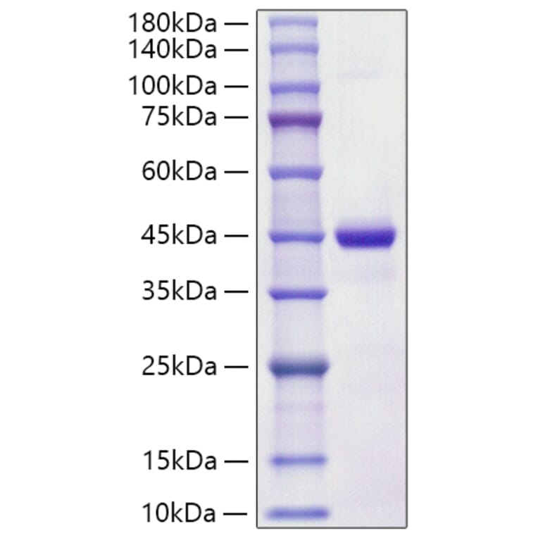 SDS-PAGE - Recombinant Human S100A7 Protein (C-terminal Human Fc Tag) (A331236) - Antibodies.com