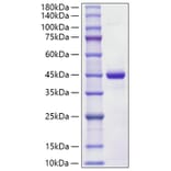 SDS-PAGE - Recombinant Human S100A7 Protein (C-terminal Human Fc Tag) (A331236) - Antibodies.com