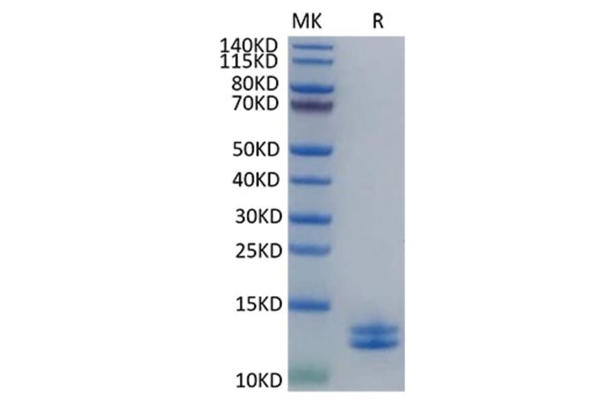Tris-Bis PAGE - Recombinant Human S100A8 + S100A9 Protein (C-terminal His Tag) (A331237) - Antibodies.com