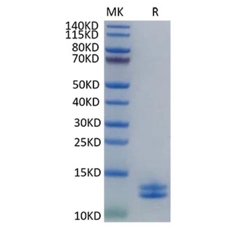 Tris-Bis PAGE - Recombinant Human S100A8 + S100A9 Protein (C-terminal His Tag) (A331237) - Antibodies.com