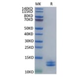 Tris-Bis PAGE - Recombinant Human S100A8 + S100A9 Protein (C-terminal His Tag) (A331237) - Antibodies.com