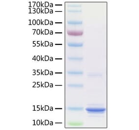 SDS-PAGE - Recombinant Human S100A9 Protein (C-terminal His Tag) (A331238) - Antibodies.com