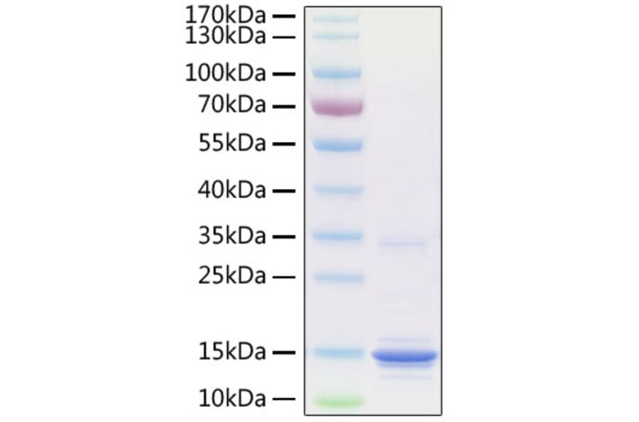 SDS-PAGE - Recombinant Human S100A9 Protein (C-terminal His Tag) (A331238) - Antibodies.com