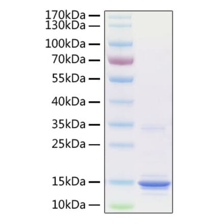 SDS-PAGE - Recombinant Human S100A9 Protein (C-terminal His Tag) (A331238) - Antibodies.com
