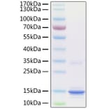 SDS-PAGE - Recombinant Human S100A9 Protein (C-terminal His Tag) (A331238) - Antibodies.com