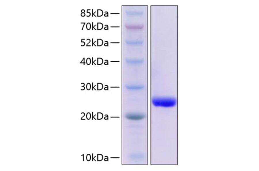 SDS-PAGE - Recombinant Human SAP Protein (C-terminal His Tag) (A331239) - Antibodies.com