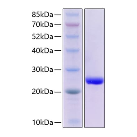 SDS-PAGE - Recombinant Human SAP Protein (C-terminal His Tag) (A331239) - Antibodies.com