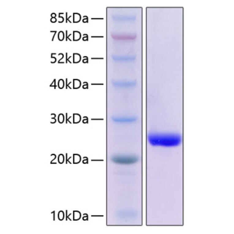 SDS-PAGE - Recombinant Human SAP Protein (C-terminal His Tag) (A331239) - Antibodies.com