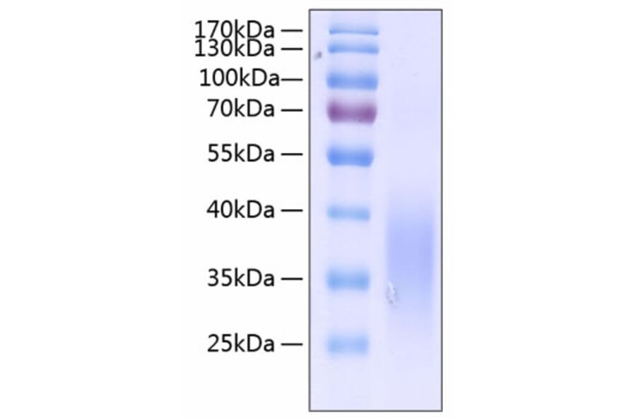 SDS-PAGE - Recombinant Human SCF Protein (C-terminal His Tag) (A331240) - Antibodies.com