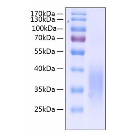 SDS-PAGE - Recombinant Human SCF Protein (C-terminal His Tag) (A331240) - Antibodies.com