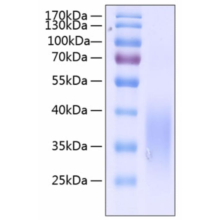 SDS-PAGE - Recombinant Human SCF Protein (C-terminal His Tag) (A331240) - Antibodies.com