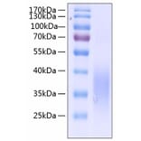 SDS-PAGE - Recombinant Human SCF Protein (C-terminal His Tag) (A331240) - Antibodies.com