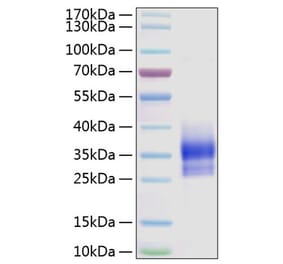 SDS-PAGE - Recombinant Human Sclerostin Protein (N-terminal His Tag) (A331241) - Antibodies.com
