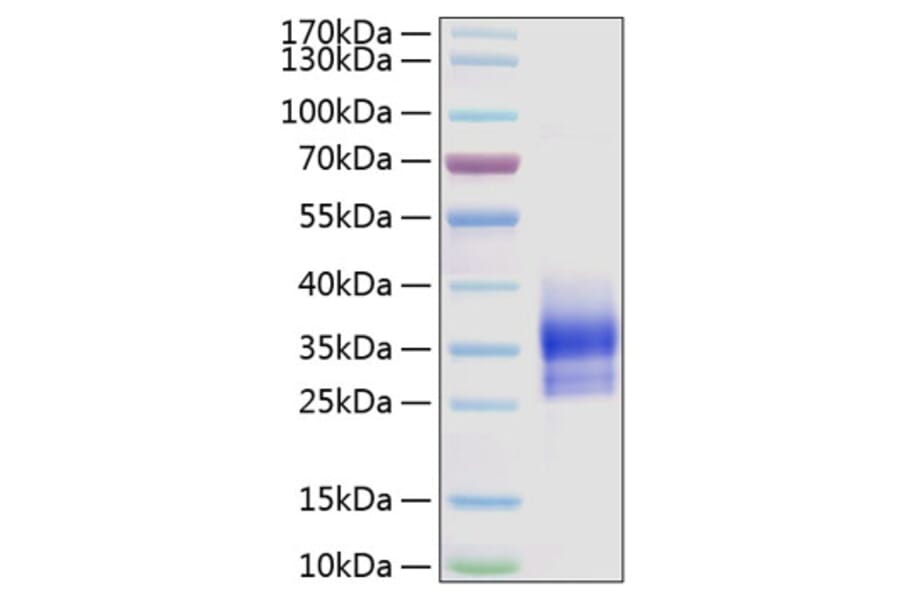 SDS-PAGE - Recombinant Human Sclerostin Protein (N-terminal His Tag) (A331241) - Antibodies.com