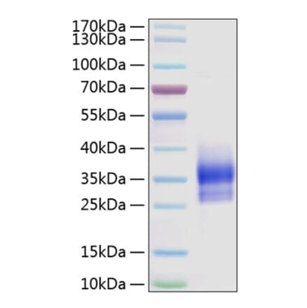 SDS-PAGE - Recombinant Human Sclerostin Protein (N-terminal His Tag) (A331241) - Antibodies.com