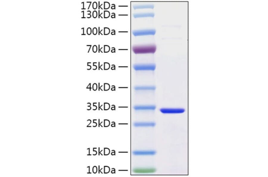 SDS-PAGE - Recombinant Human Secretagogin Protein (C-terminal His Tag) (A331242) - Antibodies.com