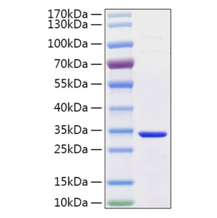 SDS-PAGE - Recombinant Human Secretagogin Protein (C-terminal His Tag) (A331242) - Antibodies.com