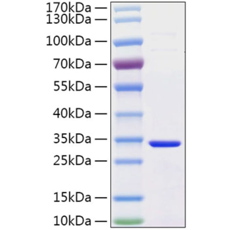 SDS-PAGE - Recombinant Human Secretagogin Protein (C-terminal His Tag) (A331242) - Antibodies.com