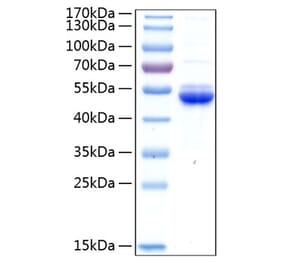 SDS-PAGE - Recombinant Human SECTM1 Protein (C-terminal Human Fc and His Tag) (A331243) - Antibodies.com
