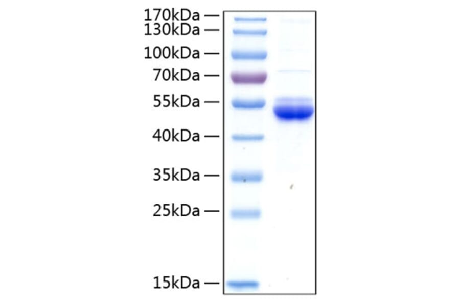 SDS-PAGE - Recombinant Human SECTM1 Protein (C-terminal Human Fc and His Tag) (A331243) - Antibodies.com