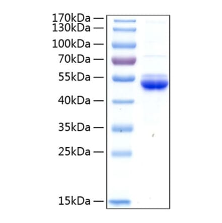 SDS-PAGE - Recombinant Human SECTM1 Protein (C-terminal Human Fc and His Tag) (A331243) - Antibodies.com