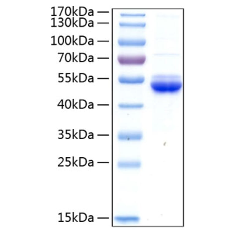 SDS-PAGE - Recombinant Human SECTM1 Protein (C-terminal Human Fc and His Tag) (A331243) - Antibodies.com