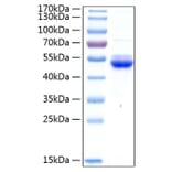 SDS-PAGE - Recombinant Human SECTM1 Protein (C-terminal Human Fc and His Tag) (A331243) - Antibodies.com